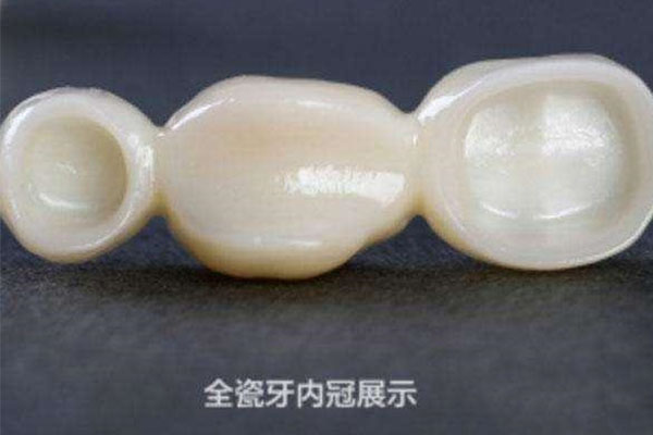 二氧化锆假牙跟全瓷牙一样么(二氧化锆全瓷牙有假的吗)