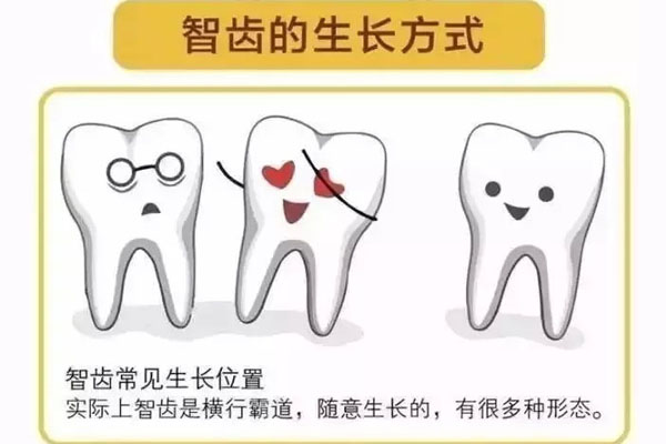 为什么智齿长歪了不能磨