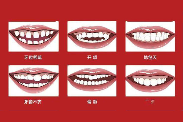 就一颗牙不齐矫正需要多长时间能好