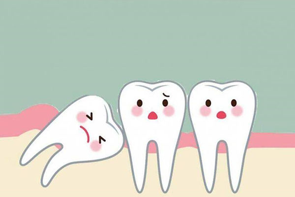 中位近中阻生智齿拔掉价格(中位近中阻生智齿怎么拔)