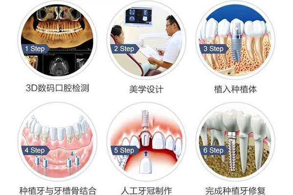 一颗牙没了不种牙有什么影响嘛(一颗