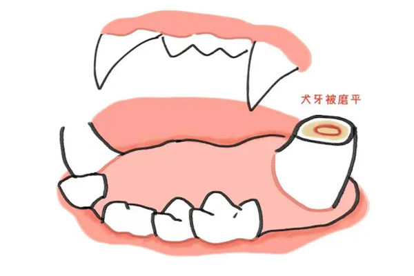 牙齿修牙证明(牙齿修牙证明图片)