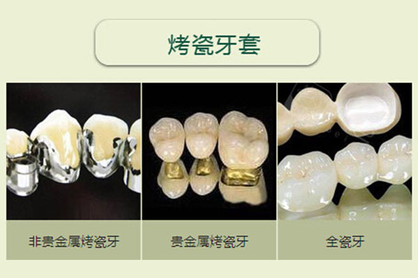 六十多岁种牙好还是镶牙好一点(六十多岁种牙好还是镶牙好一点