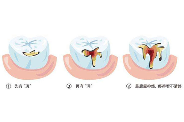 上海哪些医院补牙可以用医保卡(上海哪些医院补牙可以用医保卡