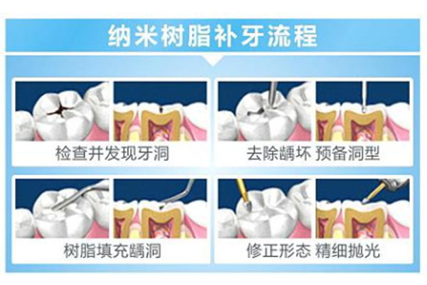 三甲医院补牙可以刷社保吗(三甲医院补牙可以用社保吗)