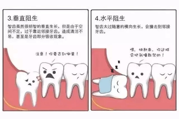上颌智齿的上面为啥有个空腔(智齿上颚有吗)
