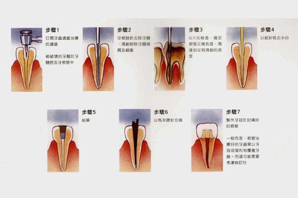 一般补一颗牙齿多少钱左右(一般补一颗牙齿多少钱左右图片)
