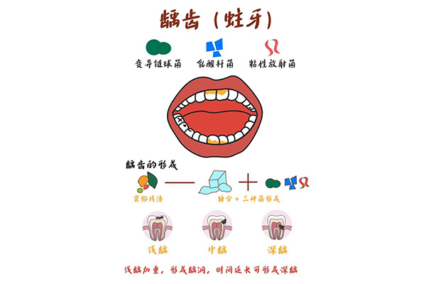 4岁孩子蛀牙牙疼怎么办(4岁孩子蛀牙