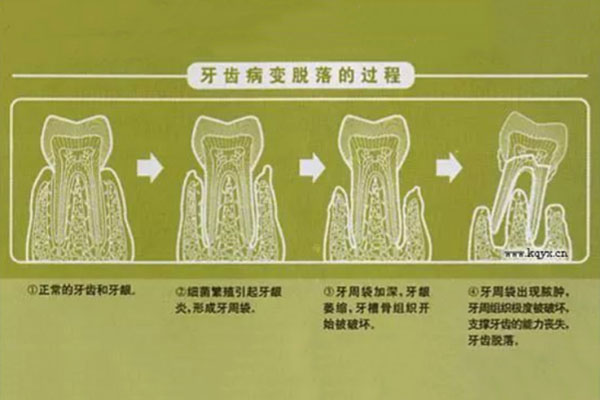 乳牙掉牙顺序不对是什么原因引起的