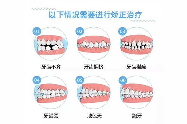 成人龅牙手术矫正需要多少费用(成人龅牙牙齿矫正多少钱)