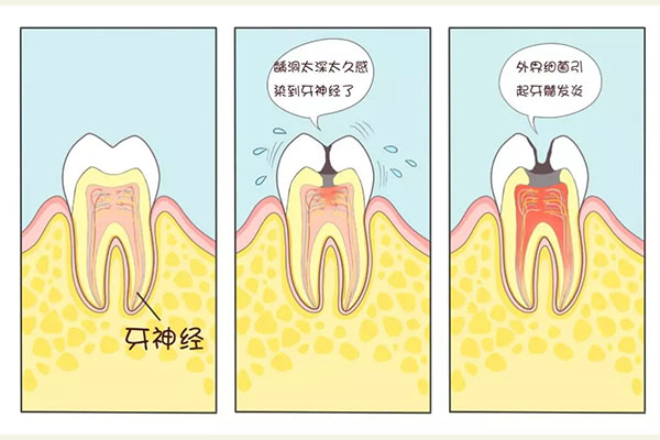4岁宝宝龋齿没必要补牙(4岁宝宝龋齿没必要补牙怎么办)