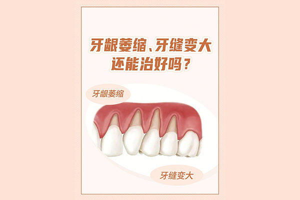 中医讲牙龈萎缩是怎么回事儿吃什么药(中医讲牙龈萎缩是怎么回