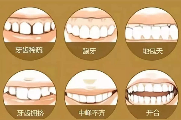 牙齿矫正后中线不齐下巴有点歪怎么
