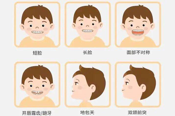 错颌畸形牙齿错位牙列不齐怎么办(错