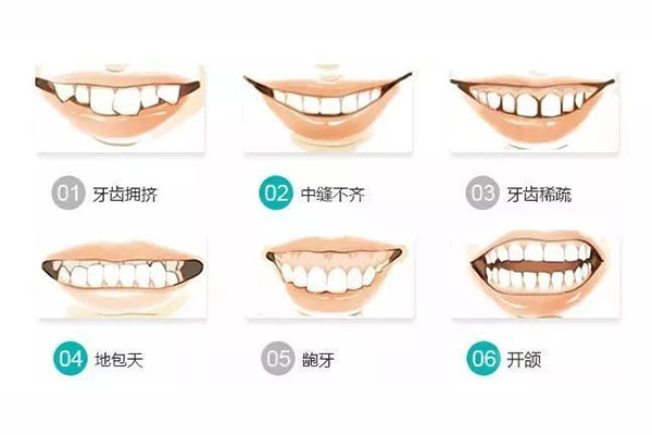 牙齿不齐除了矫正还有什么办法可以矫正好(牙齿不齐除了矫正还