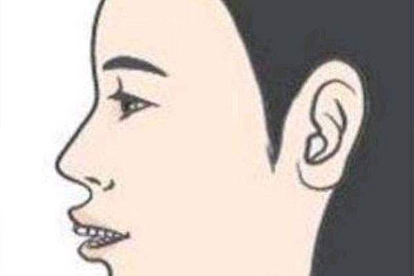 上海九院儿童地包天挂什么科(上海九