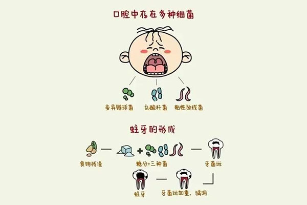 26岁蛀牙严重嘛为什么(26岁蛀牙严重嘛