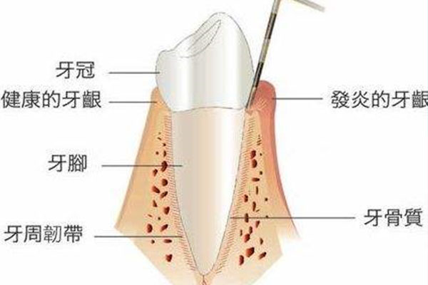 乳牙怎么快速脱落(乳牙怎么快速脱落