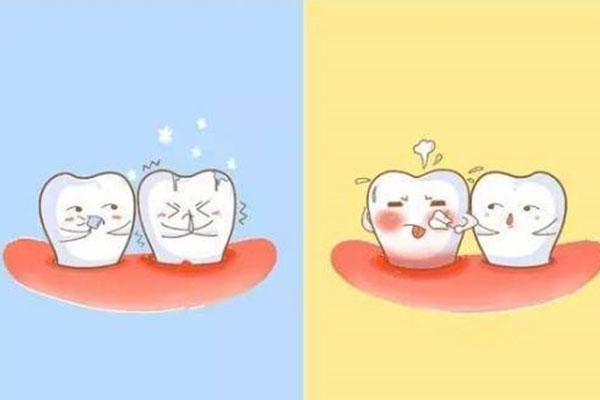 牙齿缺损一大块怎么修复多少钱一颗