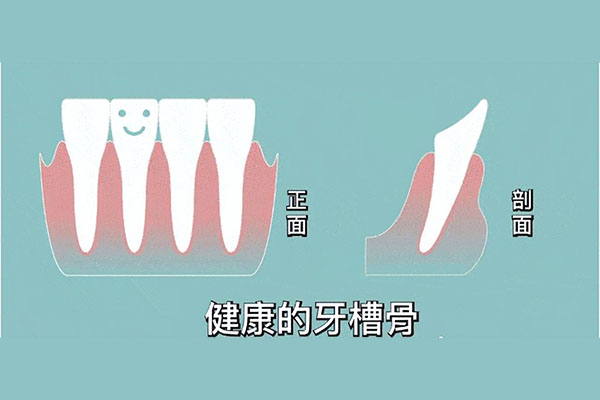 牙缺损有几种修复方式呢怎么治疗(牙