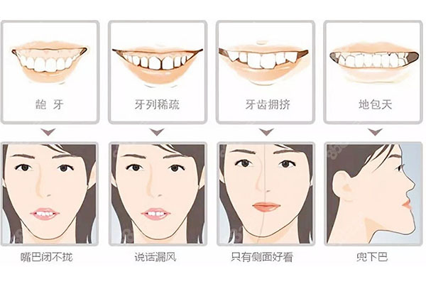牙齿怎样算不齐整齐(牙齿怎样算不齐整齐图片)知识丰富