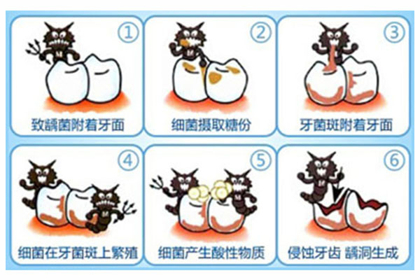 3岁小孩门牙蛀牙眼睛(三岁小朋友门牙有虫洞)