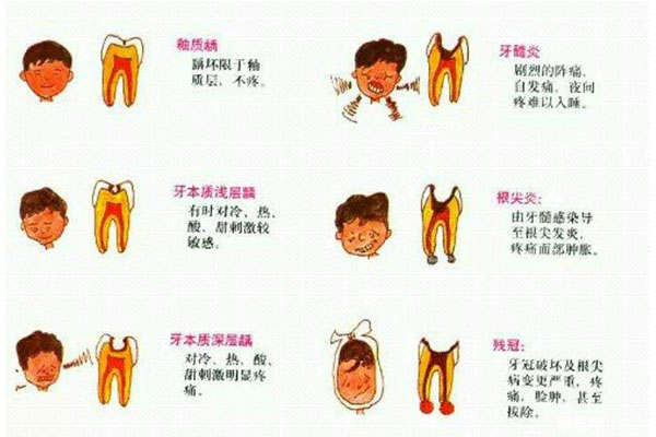 中医解释牙周炎的病因是什么引起的呢(中医解释牙周炎的病因是