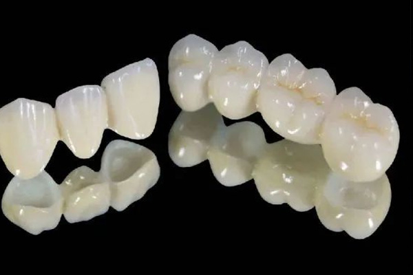 做牙冠收费分前牙区和后牙区(牙冠前牙贵还是后牙贵?)