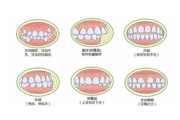 牙齿不齐是怎么回事儿(牙齿不齐是怎