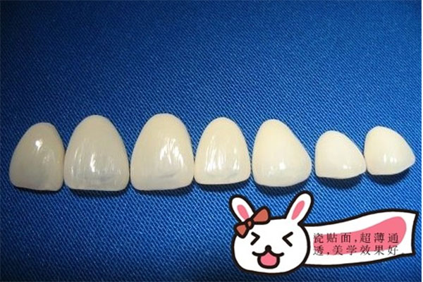 全瓷牙贴面多少钱一颗牙套啊(全瓷牙