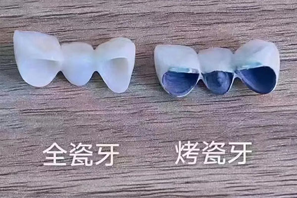 假牙取下来怎么存放(假牙取下来怎么存放最好)