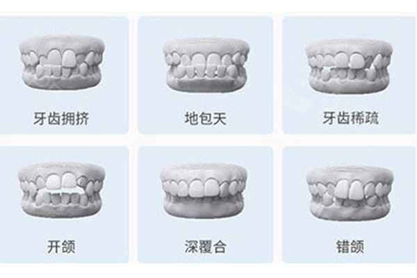 牙齿矫正完不戴保持器会龅牙嘛(矫正牙齿后不戴保持器会不会过