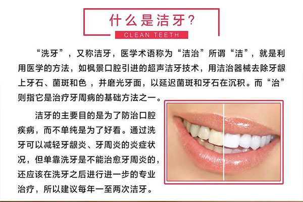 洁牙以后牙缝特别大正常吗怎么办呀