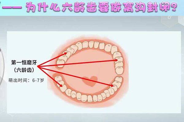 六龄牙共有几颗(六龄牙共有几颗牙齿