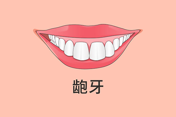 牙齿越来越龅牙怎么回事(牙齿越来越龅了怎么办)
