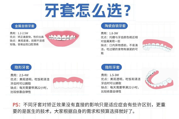 合肥 正畸(合肥正畸医生推荐)
