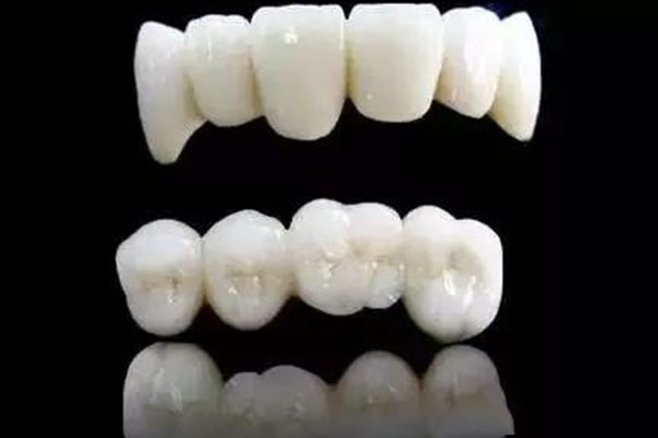 假牙二氧化锆价格(假牙二氧化锆价格