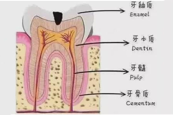 乳牙根尖周炎治疗成功的标准有哪些(乳牙根尖周炎治疗成功的标