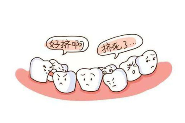 牙齿拥挤度一般分为三度为(牙齿拥挤