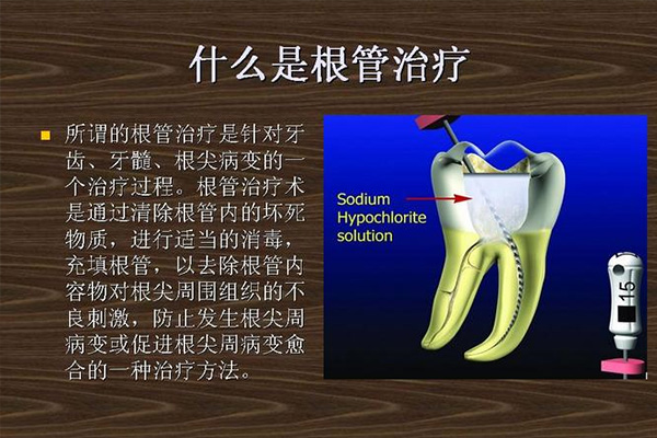 上海做根管治疗哪个医院好(上海做根