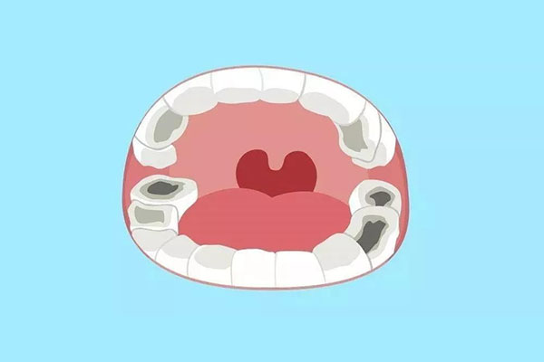 4岁小孩虫牙疼怎么治疗(四岁小孩虫牙疼怎么办立刻止疼)