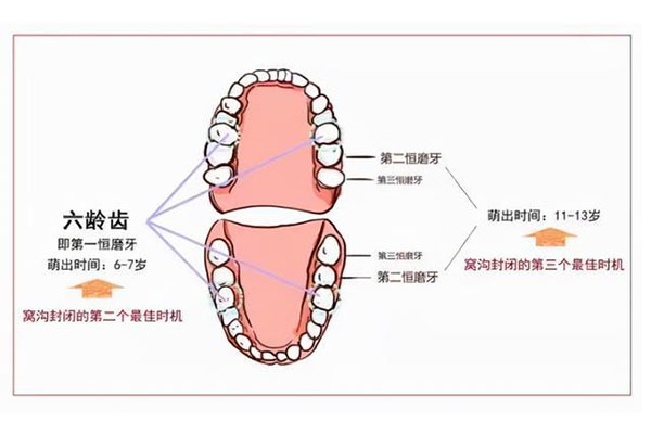 先长六龄牙再换牙(先长六龄牙再换牙