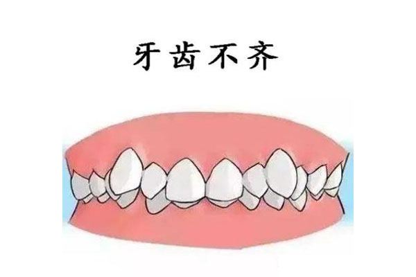牙齿不齐用牙套有没有用(牙齿不齐戴