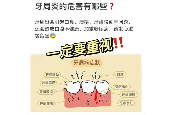 中度牙周炎怎么治疗最好的方法(中度牙周炎怎么治疗最好的方法