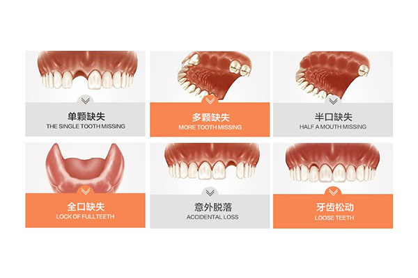 不掉牙缺什么营养素(不掉牙是缺钙吗