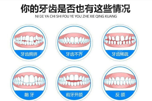 牙齿排列不齐原因(牙齿排列不齐原因