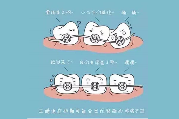 口腔正畸学重点(口腔正畸学重点知识点)