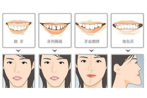 牙齿不齐贴面还是矫正效果好(牙齿不
