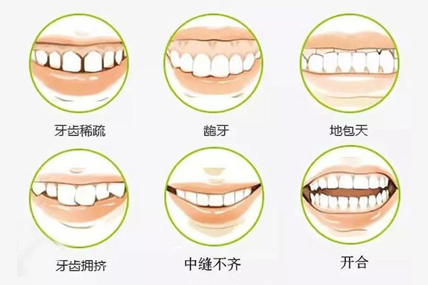牙齿不齐怎么修复(牙齿不齐怎么修复