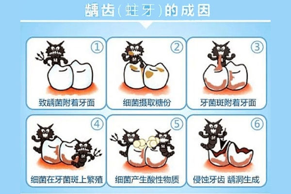 2岁半蛀牙如何让它停止腐蚀牙齿呢(2岁半蛀牙如何让它停止腐蚀